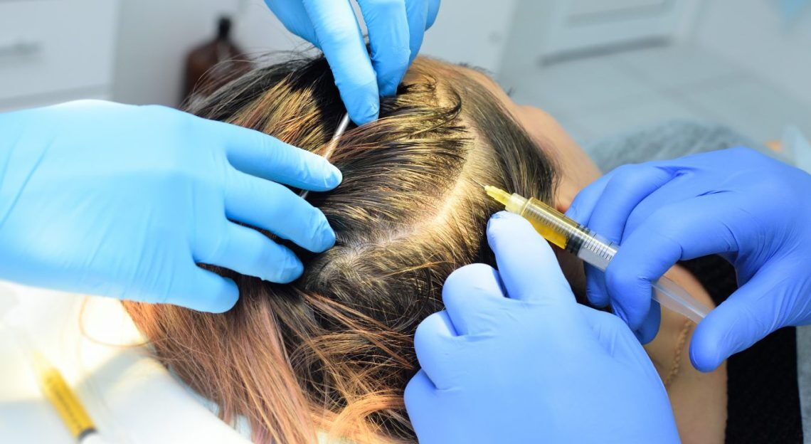 PRP/PRF HAIR INJECTION | AnewSkin Aesthetic Clinic and Medical Spa